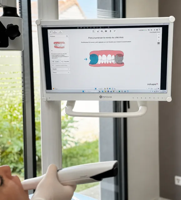 Scanner intra-oral en cours d'utilisation pour une empreinte numérique